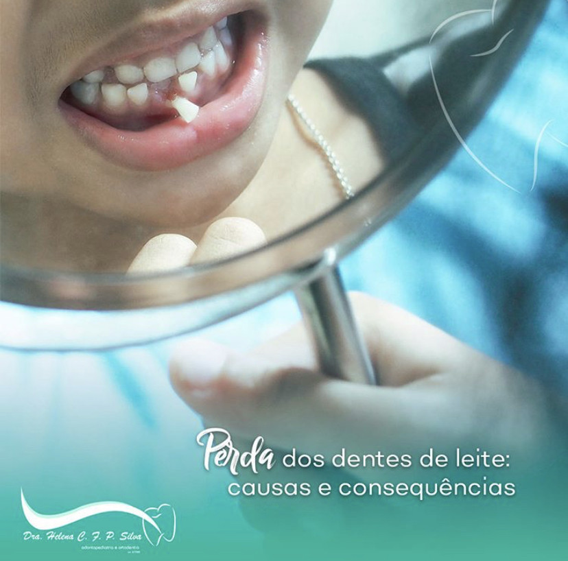 Perda dos dentes de leite: causas e consequências